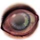 Infection H+1
